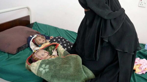 Yemen: una guerra entre grupos musulmanes que mata de hambre a los niños